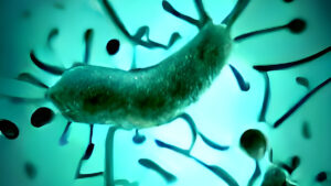 Legionnaires Disease is caused by legionella bacteria, sometimes found in the water supply of hotels and other large buildings.